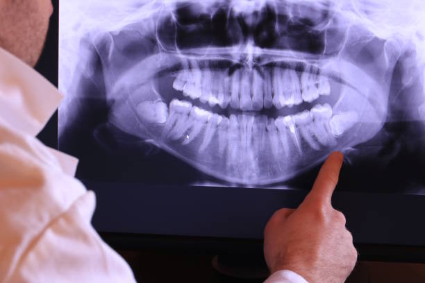Best 24-Hour Emergency Dentist in Western Lake, TX