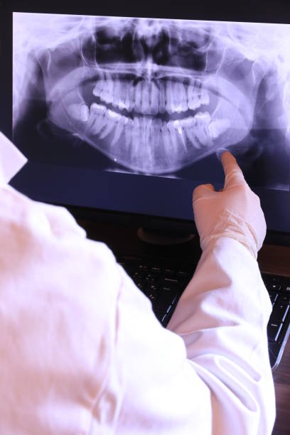 Best Emergency Dental Surgery in Western Lake, TX