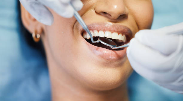Best After-Hours Emergency Dentist in Western Lake, TX