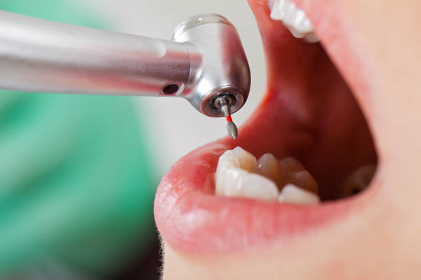 Best Emergency Dental Care for Trauma or Injury in Western Lake, TX